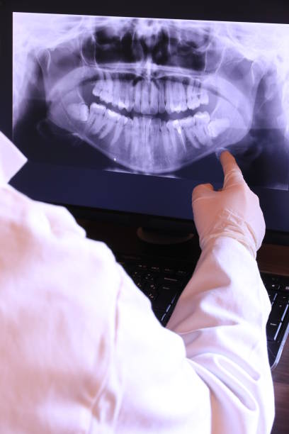 Best Emergency Treatment for Oral Infections in Diamond Springs, CA