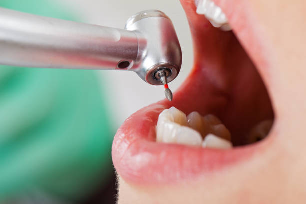 Best Emergency Treatment for Jaw Pain or Injury in Diamond Springs, CA